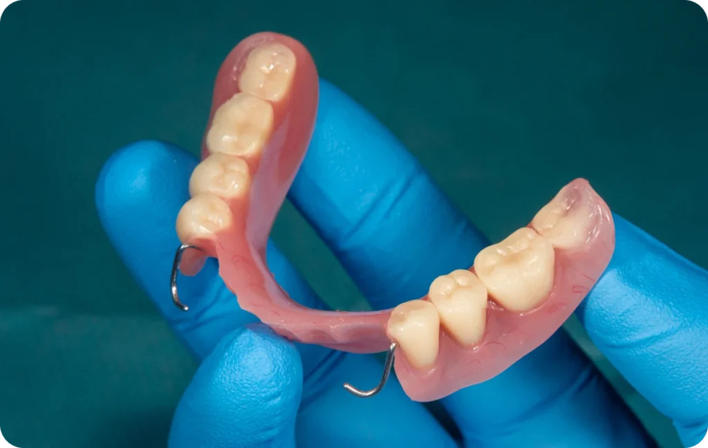 bridge dentistes ollioules bridge dentistes ollioules Prothèses amovibles Dentistes Ollioules | Cabinet dentaire Mermoz