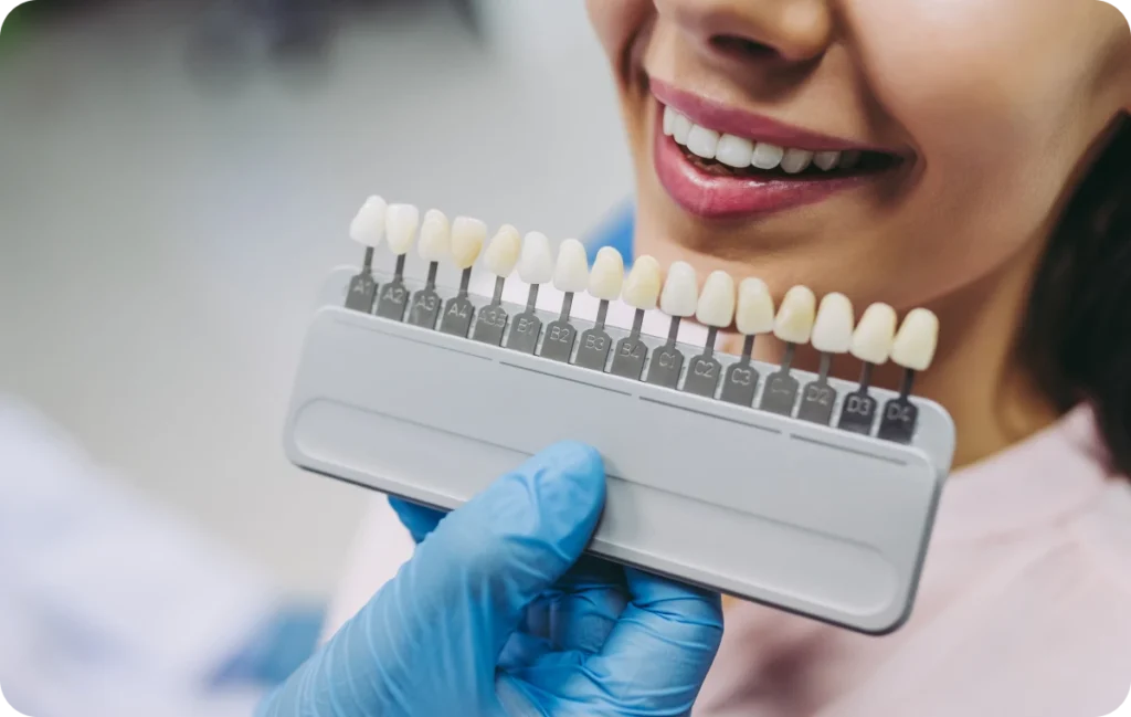 facettes dentistes ollioules facettes dentistes ollioules Facettes dentaires Dentistes Ollioules | Cabinet dentaire Mermoz
