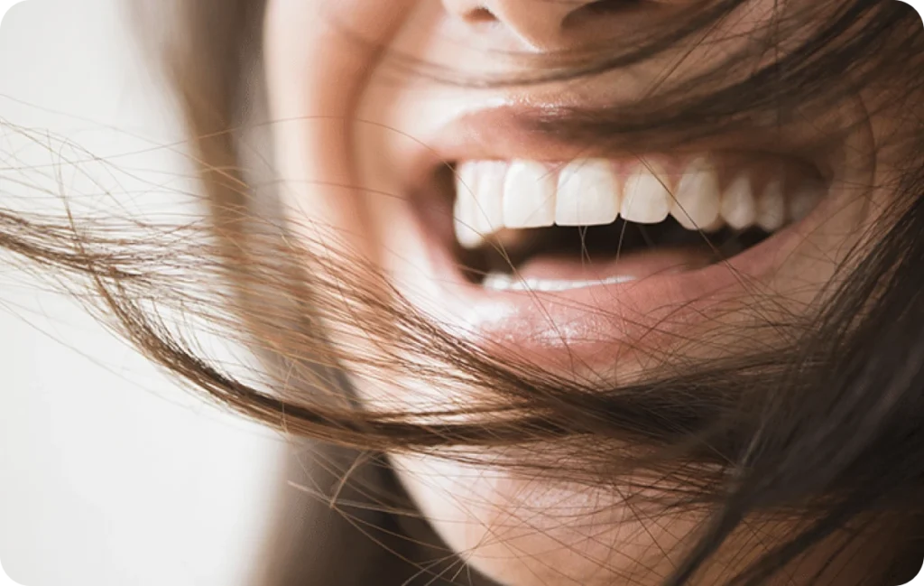sourire dentistes ollioules sourire dentistes ollioules Éclaircissement dentaire Dentistes Ollioules | Cabinet dentaire Mermoz