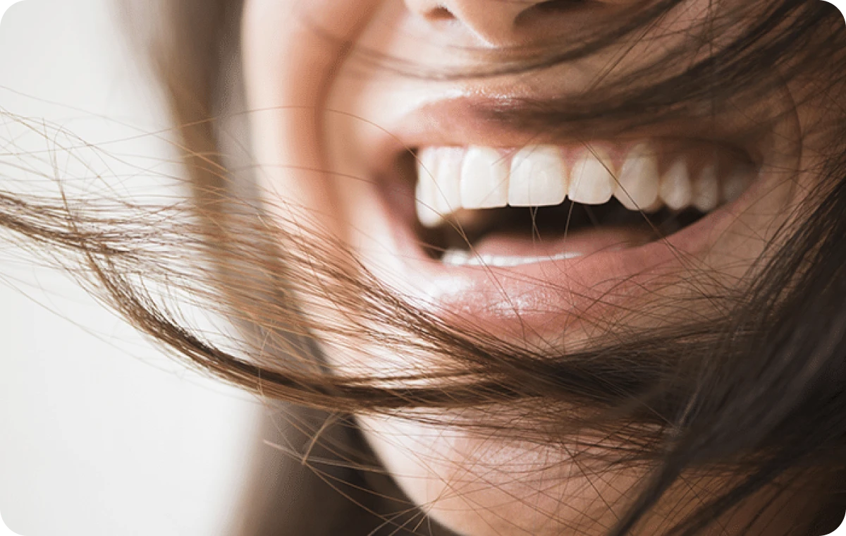 sourire dentistes ollioules Éclaircissement dentaire  Dentistes Ollioules | Cabinet dentaire Mermoz